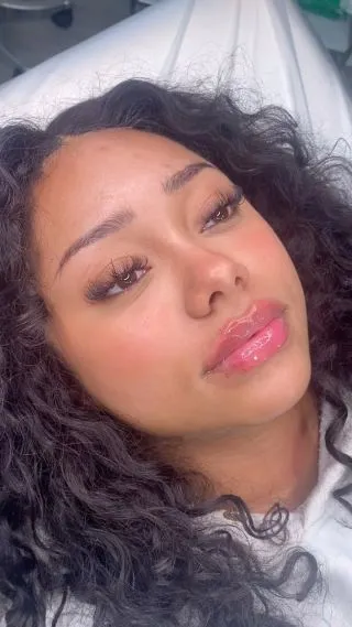 Kissable lips just in time for Valentine’s Day 💋💖

What are your plans for Valentine’s Day this year?⬇️

📍Locations:
💞Marylebone, London
💞Stevenage, Hertfordshire
💞Bury St Edmunds, Suffolk
💞Benfleet, Essex
💞Westcliff-on-Sea, Essex
💞Cambridge, Cambridgeshire 
💞Bristol 

🦋𝒮𝓅𝑒𝒸𝒾𝒶𝓁𝒾𝓈𝓉𝓈 𝒾𝓃 𝓃𝒶𝓉𝓊𝓇𝒶𝓁 𝓁𝑜𝑜𝓀𝒾𝓃𝑔 𝓇𝑒𝓈𝓊𝓁𝓉𝓈

#lipfillersessex #lipfillerlondon #lipfilleruk #lipglosslover #lipgoals #liptreatment #lipfillerbeforeandafter #lipsfiller #fillersinjection #fillerlips #lipfillerslondon #dermafillers #facialfillers #lipfillersuk #fillerinjections #hyaluronicacidfillers #fillerpic #fillertreatment #naturalfiller #dermalfillers #injectables #london #burystedmunds #stevenage #essex #cambridge #bristol