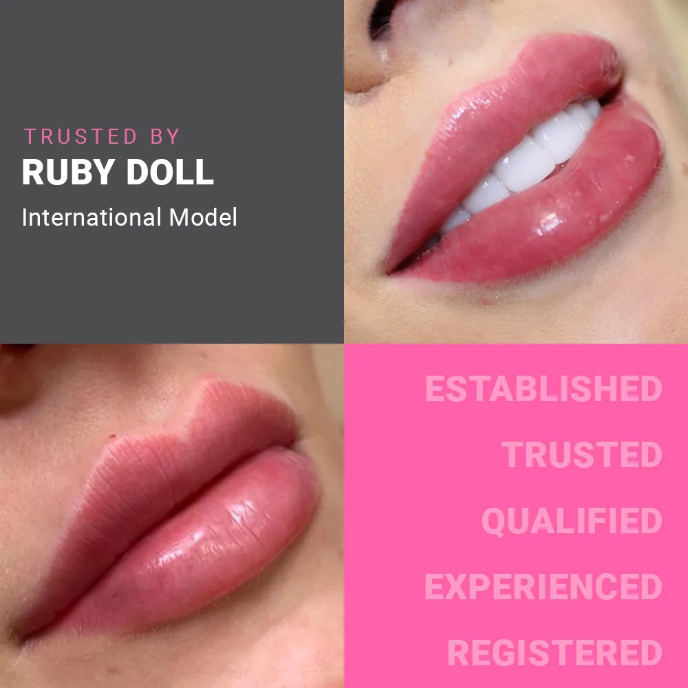 Lip Enhancement
